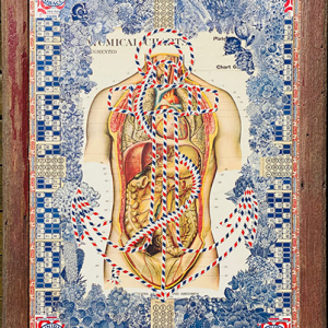 "Beautiful Anatomy Anchor" by Jason Houchen